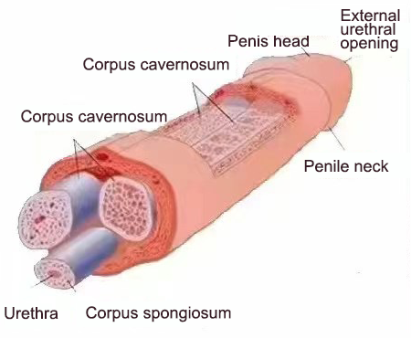 Damage to the corpus cavernosum
